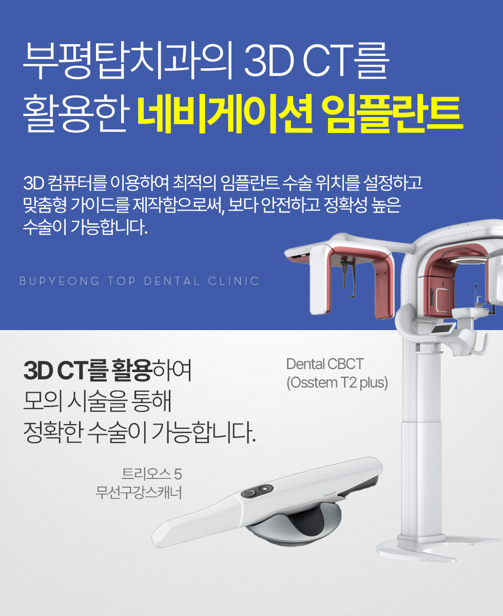 부평탑치과의 3D CT를 활용한 네비게이션 임플란트