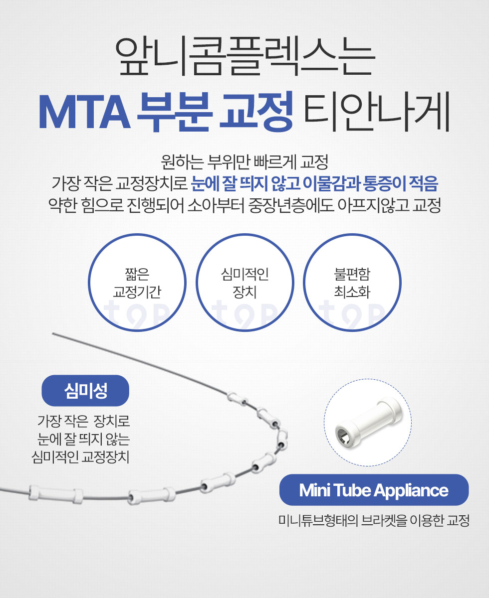 앞니콤플렉스는 MTA 부분 교정 티안나게 원하는 부위만 교정