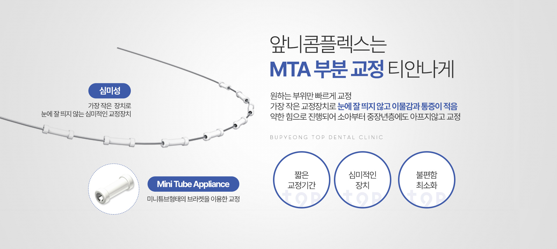 앞니콤플렉스는 MTA 부분 교정 티안나게 원하는 부위만 교정